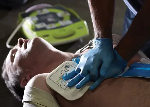 Modern hospital defibrillator on crash cart, ready for use — defibrillators in healthcare